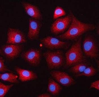 SERPINB9 Rabbit Polyclonal Antibody