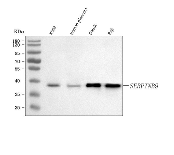 SERPINB9 Rabbit Polyclonal Antibody