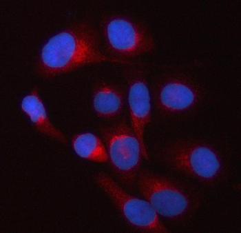TWF2 Rabbit Polyclonal Antibody