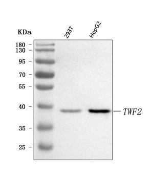 TWF2 Rabbit Polyclonal Antibody