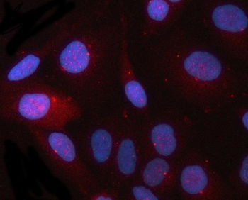 CEP164 Rabbit Polyclonal Antibody