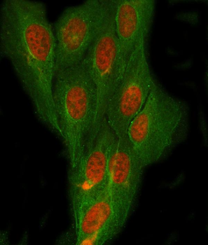 NDRG4 Rabbit Polyclonal Antibody