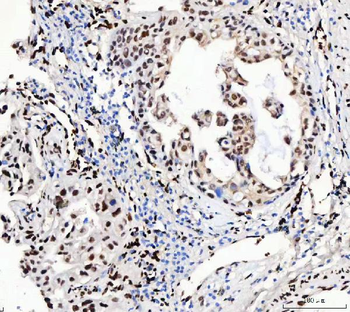 FOX2/RBM9/RBFOX2 Rabbit Polyclonal Antibody