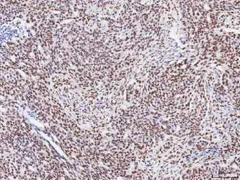 FOX2/RBM9/RBFOX2 Rabbit Polyclonal Antibody