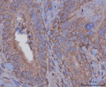 Angiotensinogen/AGT Rabbit Polyclonal Antibody