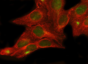 MLST8 Rabbit Polyclonal Antibody