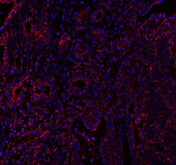 MLST8 Rabbit Polyclonal Antibody