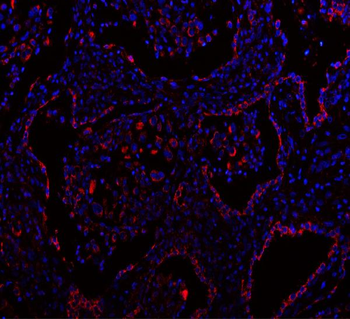 MLST8 Rabbit Polyclonal Antibody