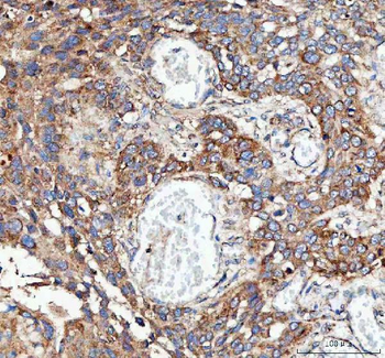 MLST8 Rabbit Polyclonal Antibody