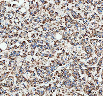 MLST8 Rabbit Polyclonal Antibody