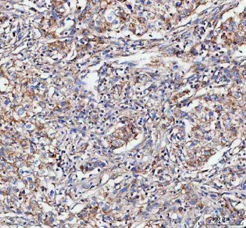 MLST8 Rabbit Polyclonal Antibody