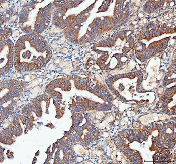 MLST8 Rabbit Polyclonal Antibody