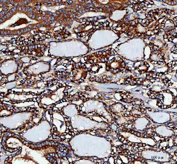 MLST8 Rabbit Polyclonal Antibody