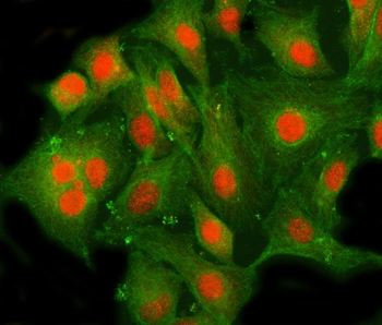 MLLT10 Rabbit Polyclonal Antibody