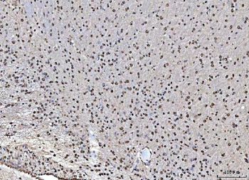 MATR3 Rabbit Polyclonal Antibody