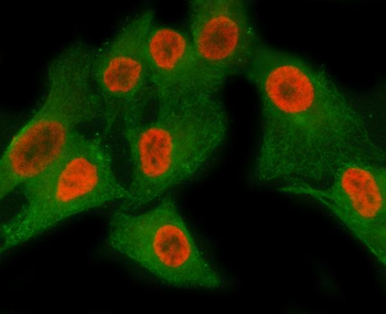 MATR3 Rabbit Polyclonal Antibody