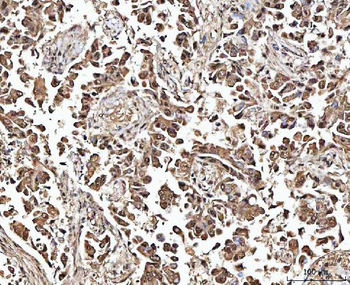 MATR3 Rabbit Polyclonal Antibody
