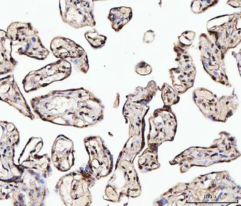 MATR3 Rabbit Polyclonal Antibody