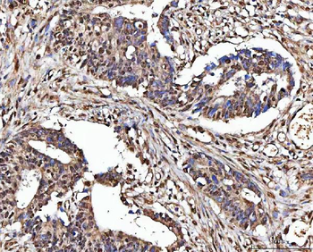 MATR3 Rabbit Polyclonal Antibody