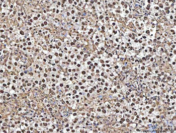 MATR3 Rabbit Polyclonal Antibody