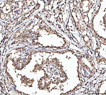 MATR3 Rabbit Polyclonal Antibody