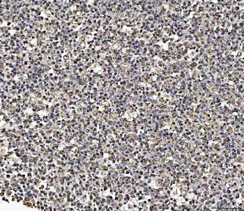 MATR3 Rabbit Polyclonal Antibody