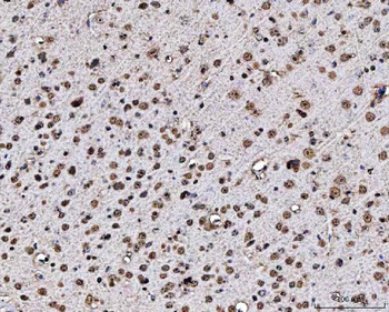 MATR3 Rabbit Polyclonal Antibody