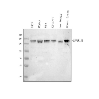 PPP1R13B Rabbit Polyclonal Antibody