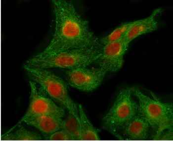 POLR2B Rabbit Polyclonal Antibody