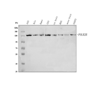 POLR2B Rabbit Polyclonal Antibody