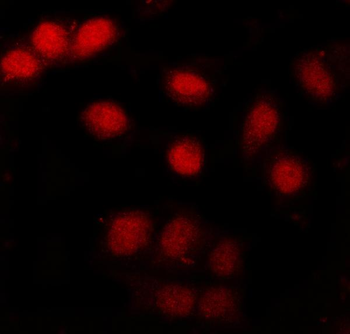 CBP20/NCBP2 Rabbit Polyclonal Antibody