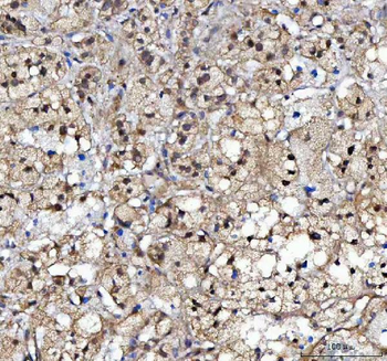 CBP20/NCBP2 Rabbit Polyclonal Antibody