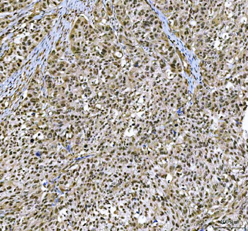 CBP20/NCBP2 Rabbit Polyclonal Antibody