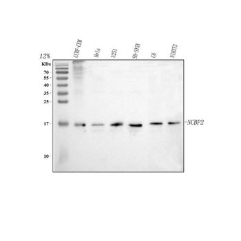 CBP20/NCBP2 Rabbit Polyclonal Antibody