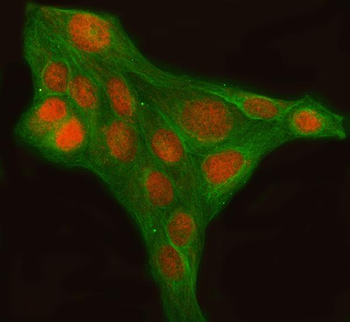 LHX6 Rabbit Polyclonal Antibody