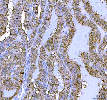 LHX6 Rabbit Polyclonal Antibody