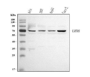 LHX6 Rabbit Polyclonal Antibody