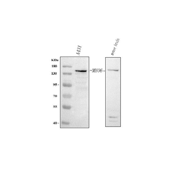 MYO6 Rabbit Polyclonal Antibody