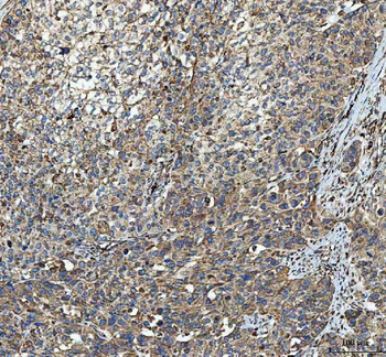 C19orf10/MYDGF Rabbit Polyclonal Antibody