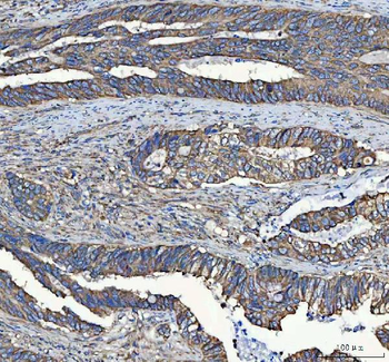 C19orf10/MYDGF Rabbit Polyclonal Antibody