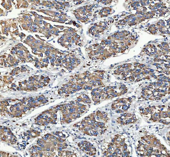 C19orf10/MYDGF Rabbit Polyclonal Antibody