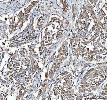 C19orf10/MYDGF Rabbit Polyclonal Antibody