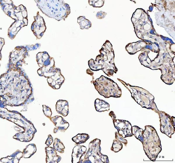 C19orf10/MYDGF Rabbit Polyclonal Antibody
