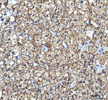 MYCBP Rabbit Polyclonal Antibody