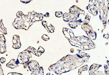 MYCBP Rabbit Polyclonal Antibody