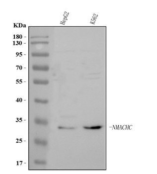 MMACHC Rabbit Polyclonal Antibody