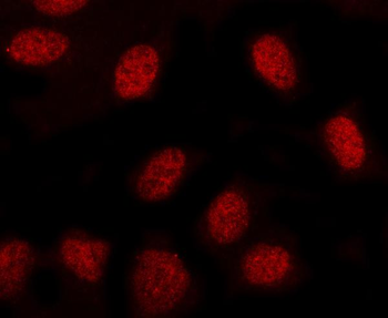 MINDY3 Rabbit Polyclonal Antibody