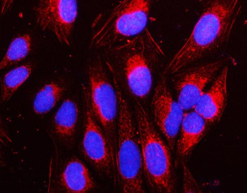 NAP1L1 Rabbit Polyclonal Antibody