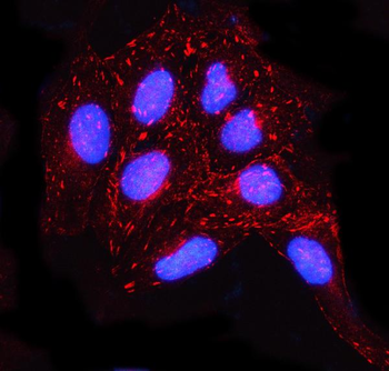 MISP Rabbit Polyclonal Antibody