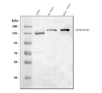 MPHOSPH9 Rabbit Polyclonal Antibody